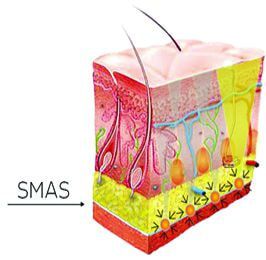 SMAS Ультразвуковая подтяжка лица